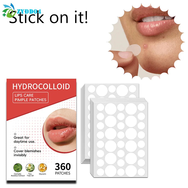 Mouth Blister Patch Cold Sore Lip