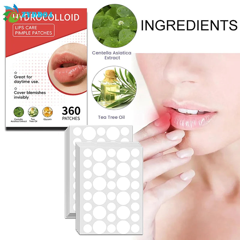 Mouth Blister Patch Cold Sore Lip