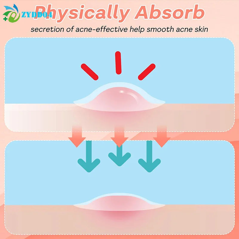 Mouth Blister Patch Cold Sore Lip